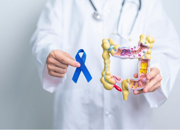Colon cancer or colorectal cancer